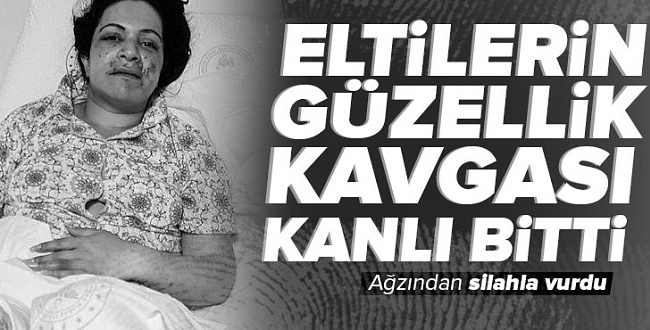 Ne Günlere Kaldık! Ben Daha Güzelim Kavgasında Silahlar Çekildi